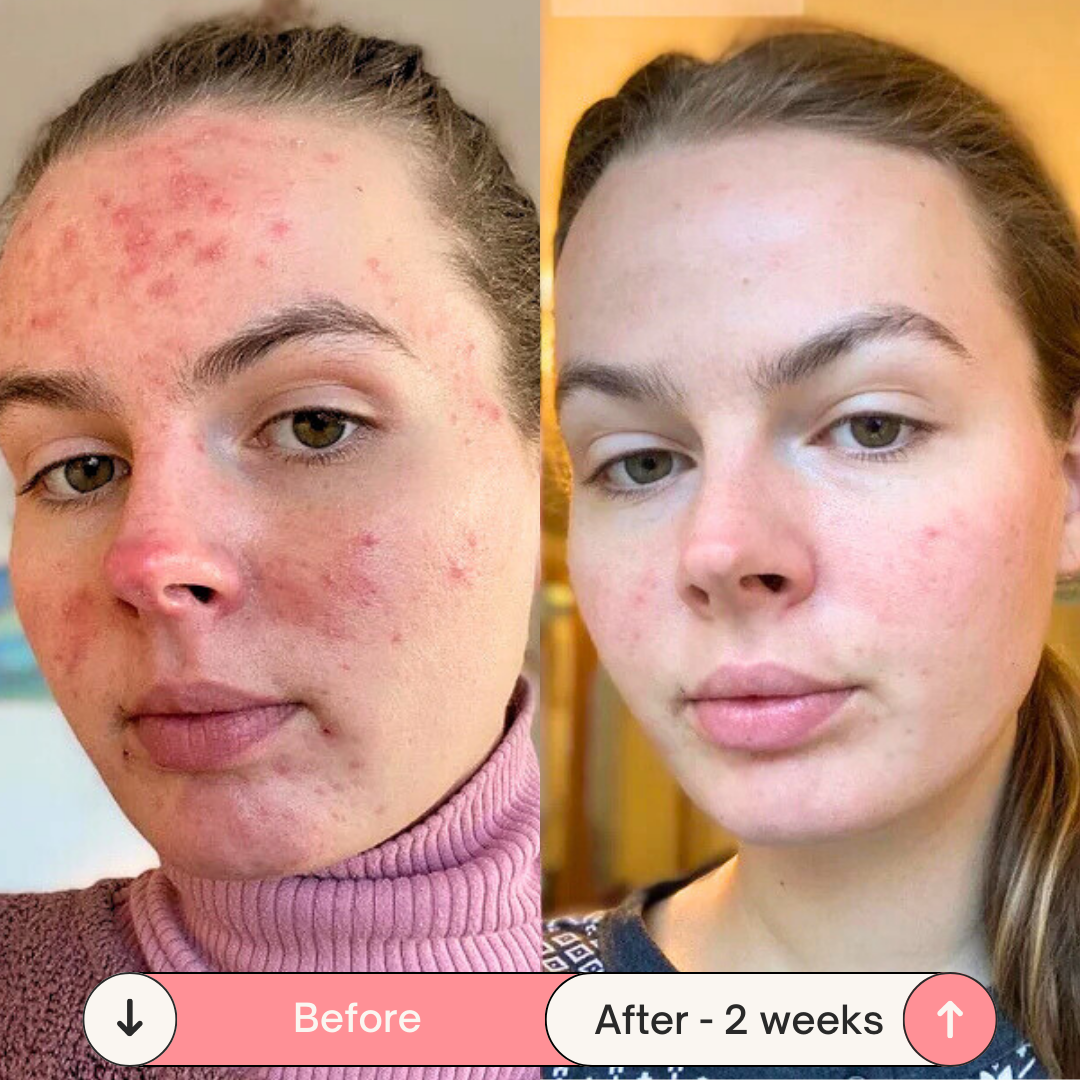 Facesculpt 2.0 - Bacchetta ad Alta Frequenza