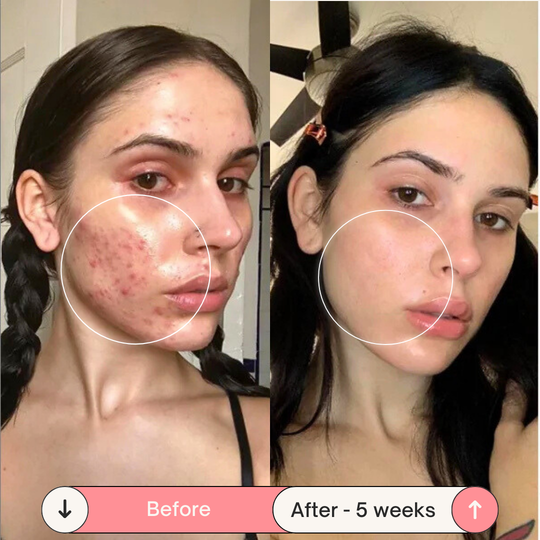 Facesculpt 2.0 - Bacchetta ad Alta Frequenza