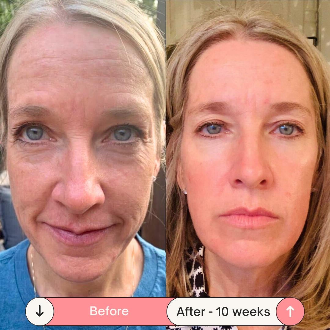 Facesculpt 2.0 - Bacchetta ad Alta Frequenza