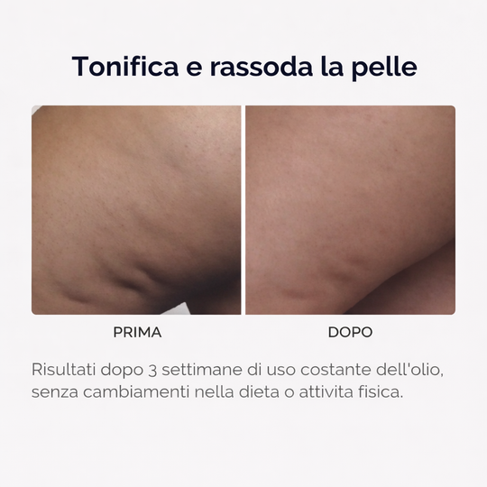 Olio Corpo Tonificante & Rassodante™