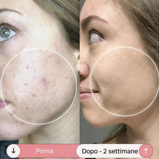 Facesculpt 2.0 - Bacchetta ad Alta Frequenza