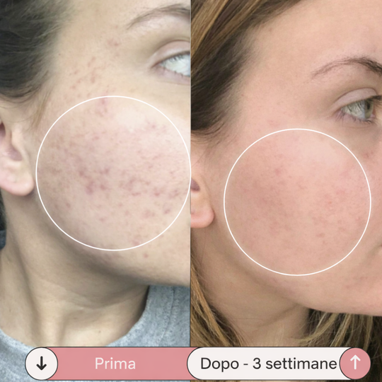 Facesculpt 2.0 - Bacchetta ad Alta Frequenza