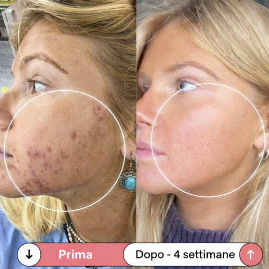 Facesculpt 2.0 - Bacchetta ad Alta Frequenza