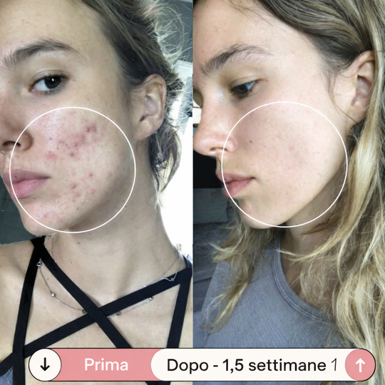 Facesculpt 2.0 - Bacchetta ad Alta Frequenza