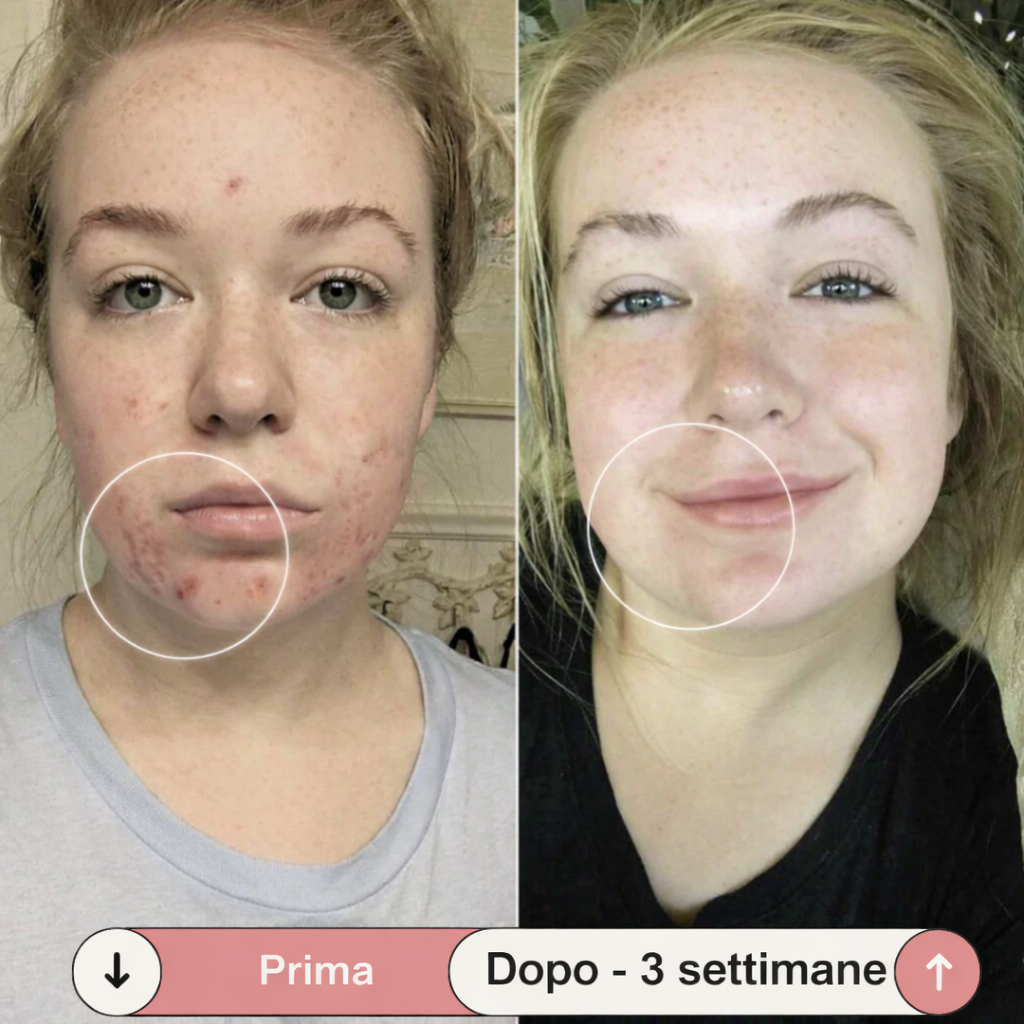 Facesculpt 2.0 - Bacchetta ad Alta Frequenza